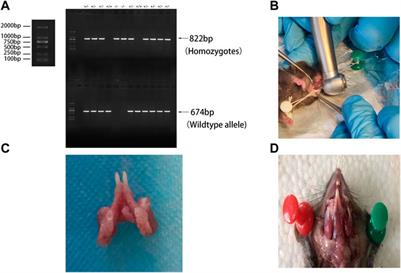 Comparison of the biomechanical differences in the occlusal movement of wild-type and BMP9 knockout mice with <mark class="highlighted">apical periodontitis</mark>
